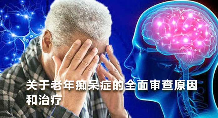 关于老年痴呆症的全面审查原因和治疗(中文版)