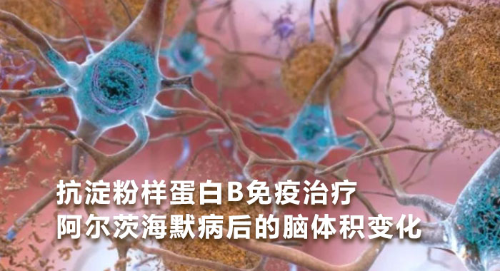 抗淀粉样蛋白β免疫治疗阿尔茨海默病后的脑体积变化(中文版)