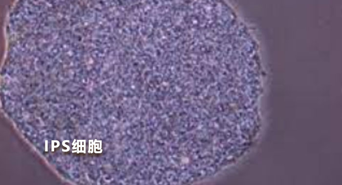 IPS细胞(中文版)