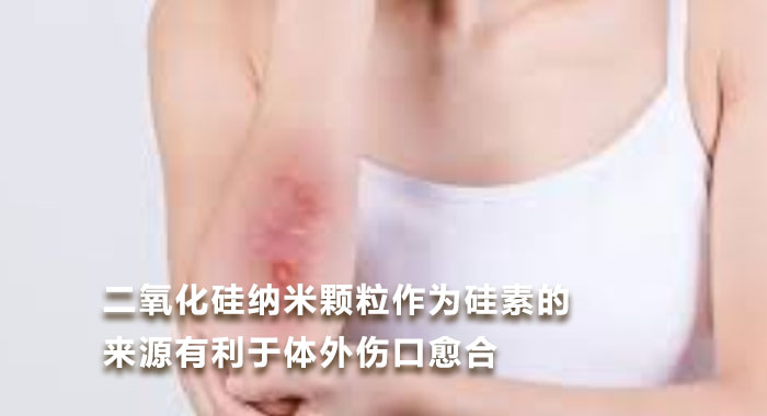 2017,二氧化硅纳米颗粒作为硅素的来源有利于体外伤口愈合(中文版)