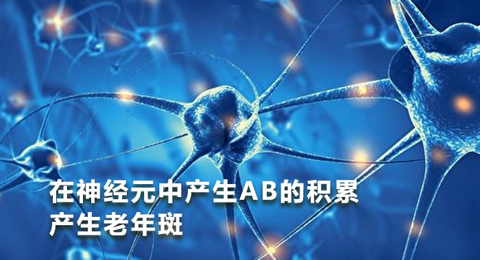 在神经元中产生AB的积累产生老年斑（英文）