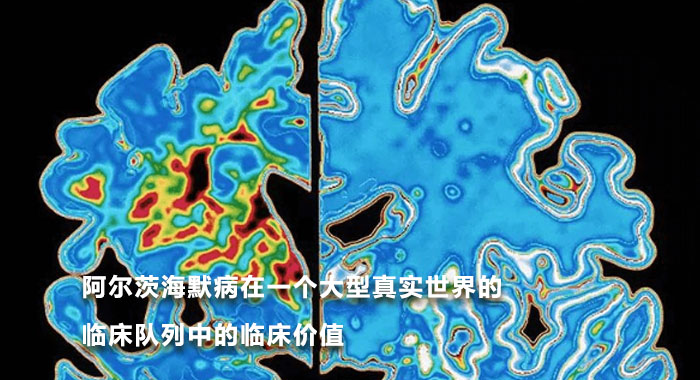 阿尔茨海默病在一个大型真实世界的临床队列中的临床价值（英文）