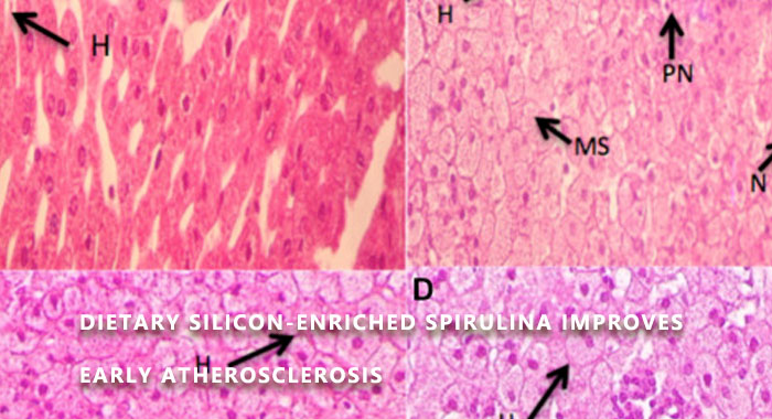 Dietary silicon-enriched spirulina improves early atherosclerosis